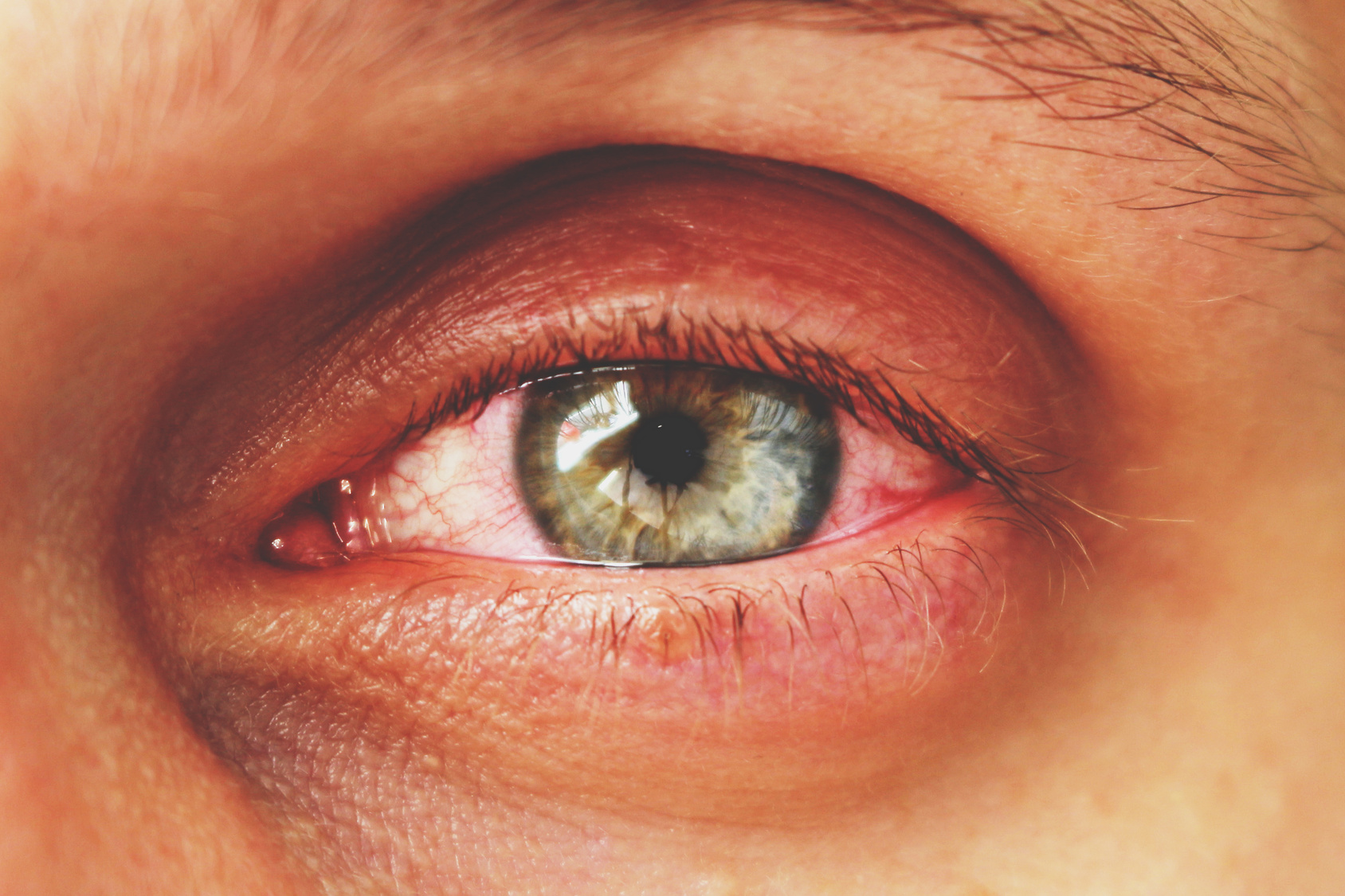 Should You Call Your Eye Doctor Or Visit The Emergency Room
